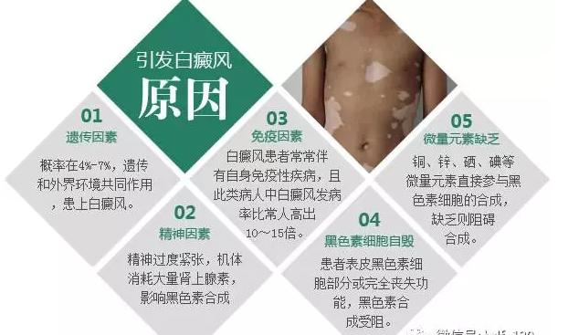 白癜风怎么提高酪氨酸,儿童腹股沟白癜风治愈率