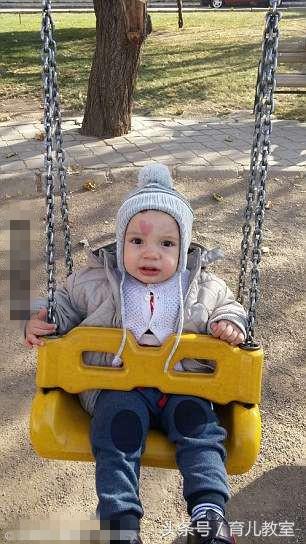 刚出生的婴儿额头有大块红色胎记，妈妈看一眼后竟热泪盈眶！