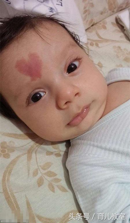 刚出生的婴儿额头有大块红色胎记，妈妈看一眼后竟热泪盈眶！