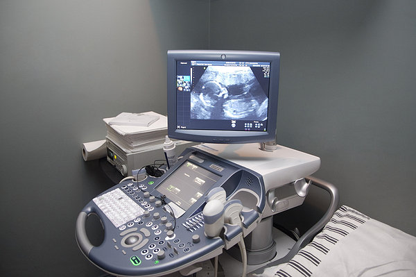 我们如何从B超单看生男生女？最后我相信了