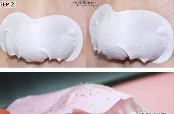 简单又有效的祛黑头方法，今天才是实在的方法