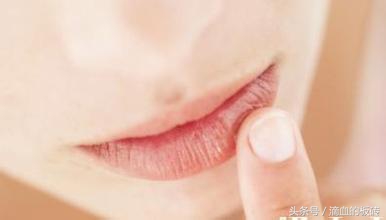 去身上死皮的正确方法,身体死皮怎么去除干净