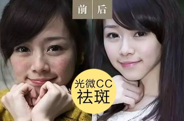 激光祛斑后还会反弹吗,激光祛斑后会不会反弹