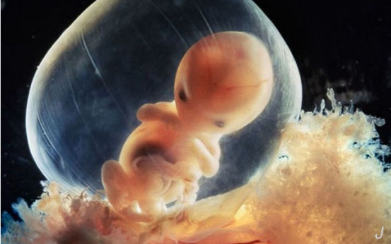 婴幼儿血管瘤会自己消除吗,血管瘤属于恶性肿瘤还是良性肿瘤