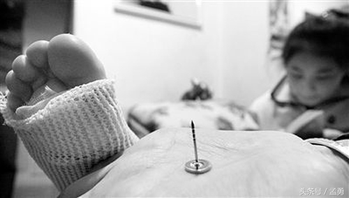 孩子受伤到医院需要打破伤风吗,破伤风疫苗受伤后多久打有效