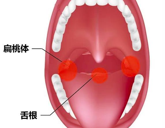 吃白鱼被鱼刺卡住了怎么办,年年有鱼怎么总是掉叶子