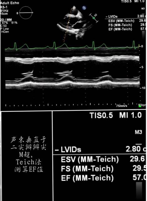 那些年我们错过的人,那些年我们错过的好歌