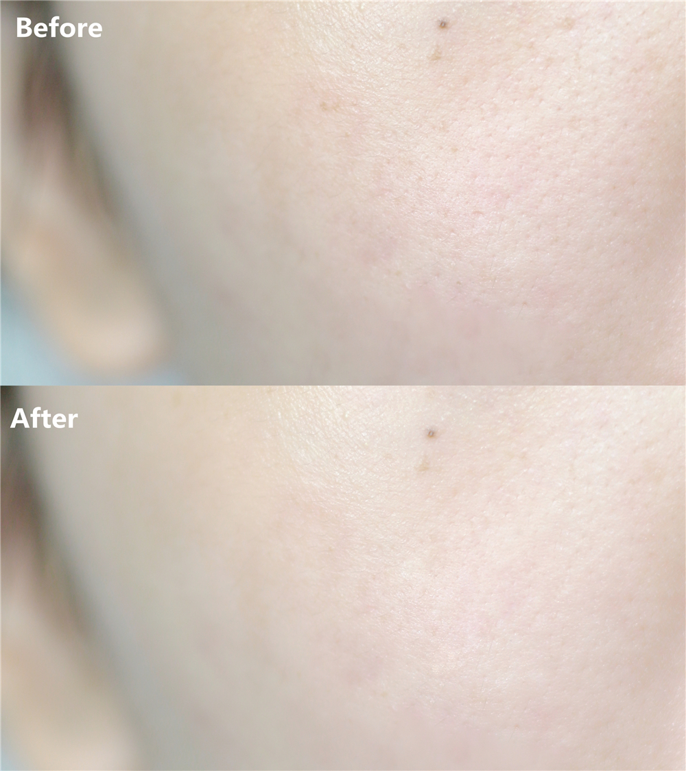 「senly」面膜界的Mr.Right，帮我Hold住水嫩肌肤