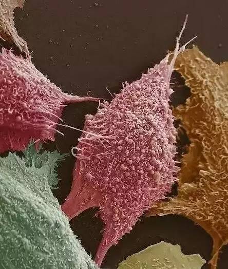 Word天！想不到癌细胞如此惊艳