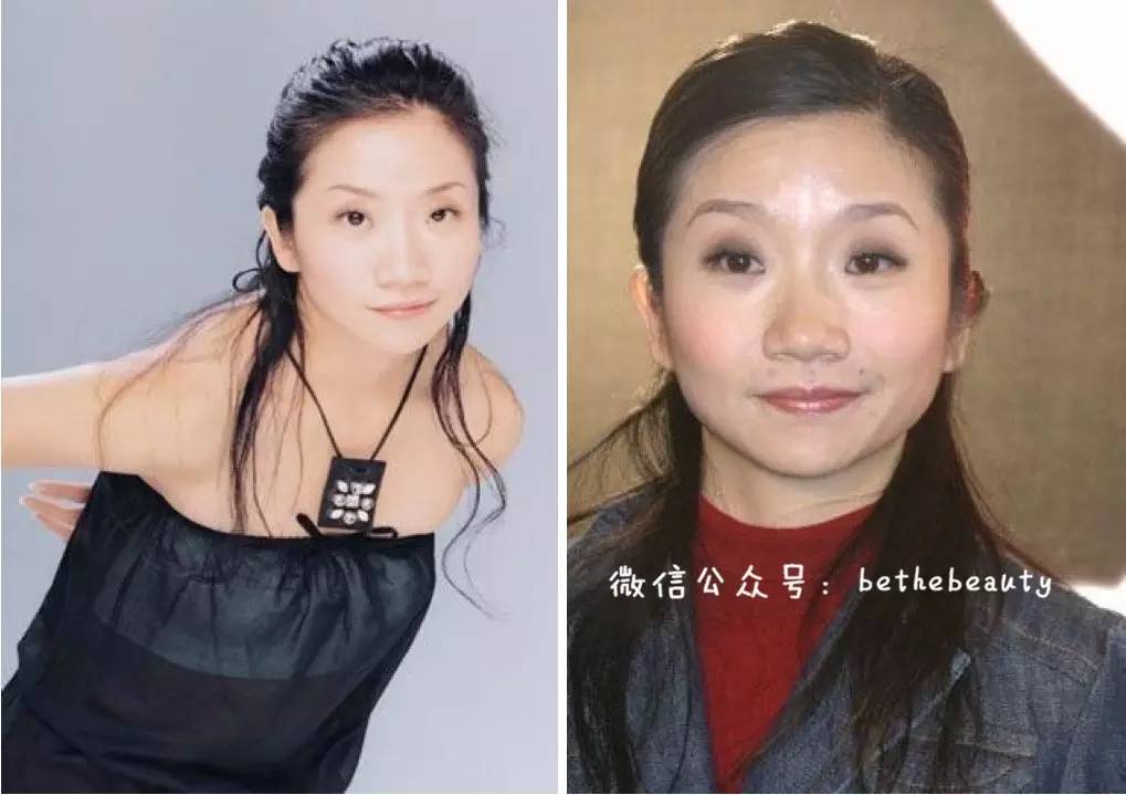 鼻子除了整容变挺还有什么办法,不想整容怎么让鼻子好看