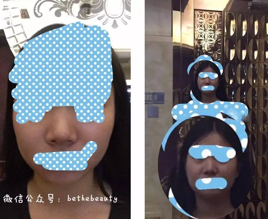 鼻子除了整容变挺还有什么办法,不想整容怎么让鼻子好看