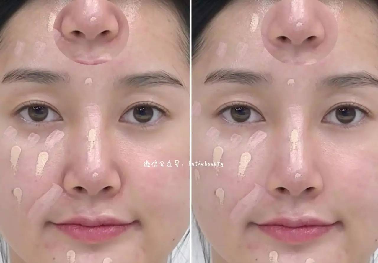 鼻子除了整容变挺还有什么办法,不想整容怎么让鼻子好看