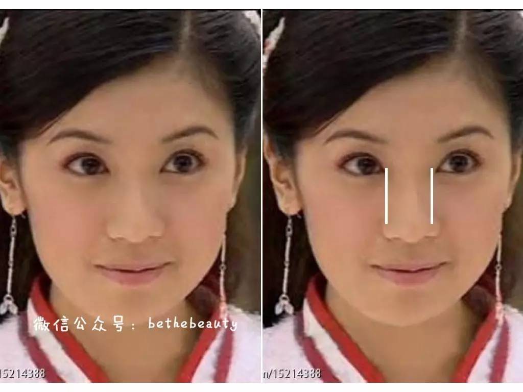 鼻子除了整容变挺还有什么办法,不想整容怎么让鼻子好看