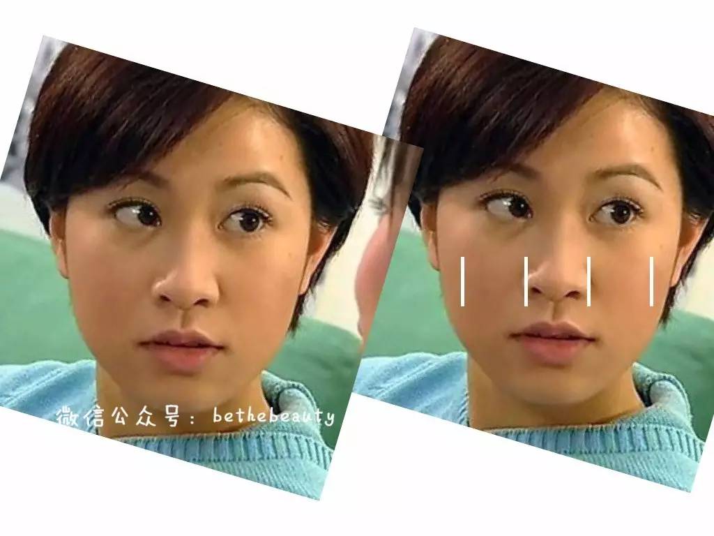 鼻子除了整容变挺还有什么办法,不想整容怎么让鼻子好看