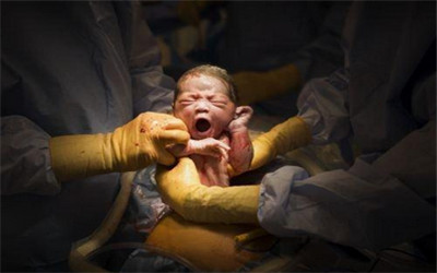 为啥好多孕妇都选择剖腹产,现在的孕妇为什么都选择剖腹产