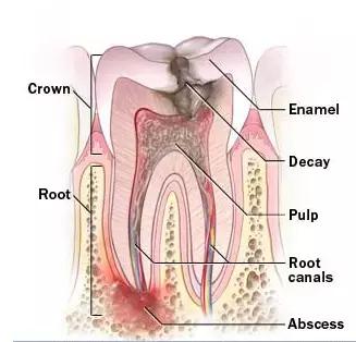 厉害了！她用缝衣针来治疗牙疼