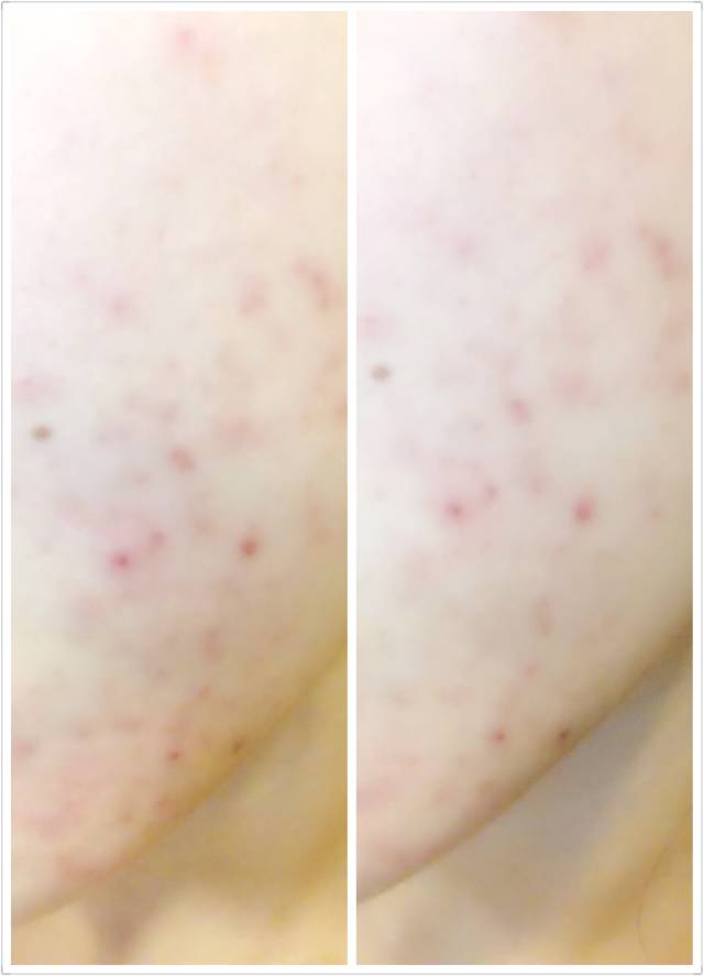 trilogy玫瑰果油测评,澳洲玫瑰果油trilogy