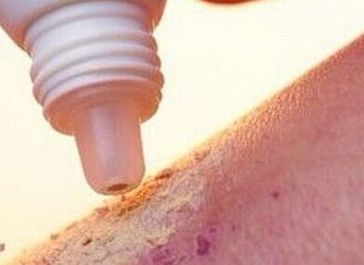 什么药治疗婴儿湿疹最好,如何挑选宝宝湿疹药膏