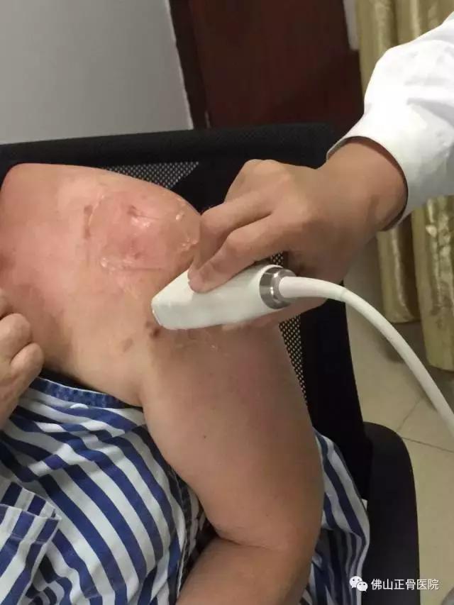 肌骨康复治疗技术讲解视频,康复学堂肩袖损伤康复训练