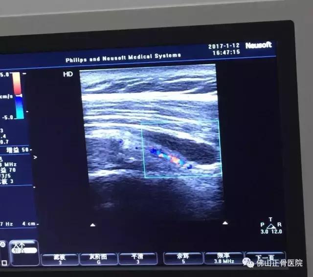肌骨康复治疗技术讲解视频,康复学堂肩袖损伤康复训练