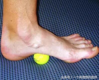 跟骨痛的康复训练方法,跟骨痛的封闭疗法