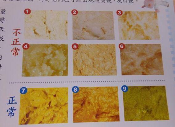 婴儿大便墨绿色是吓到了吗,为什么一个多月的宝宝大便有点黑