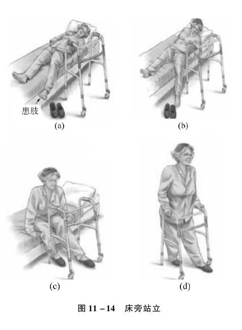 老年骨折康复训练,老年患者骨折治疗原则