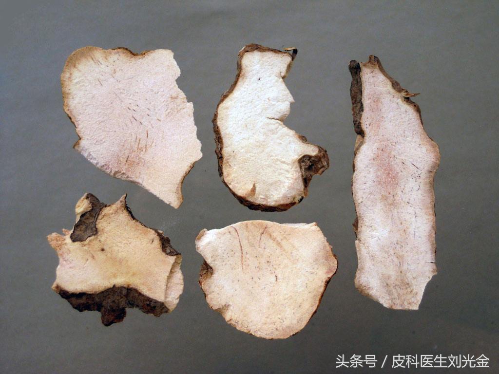 大道至简中医自学,中药治银屑病处方