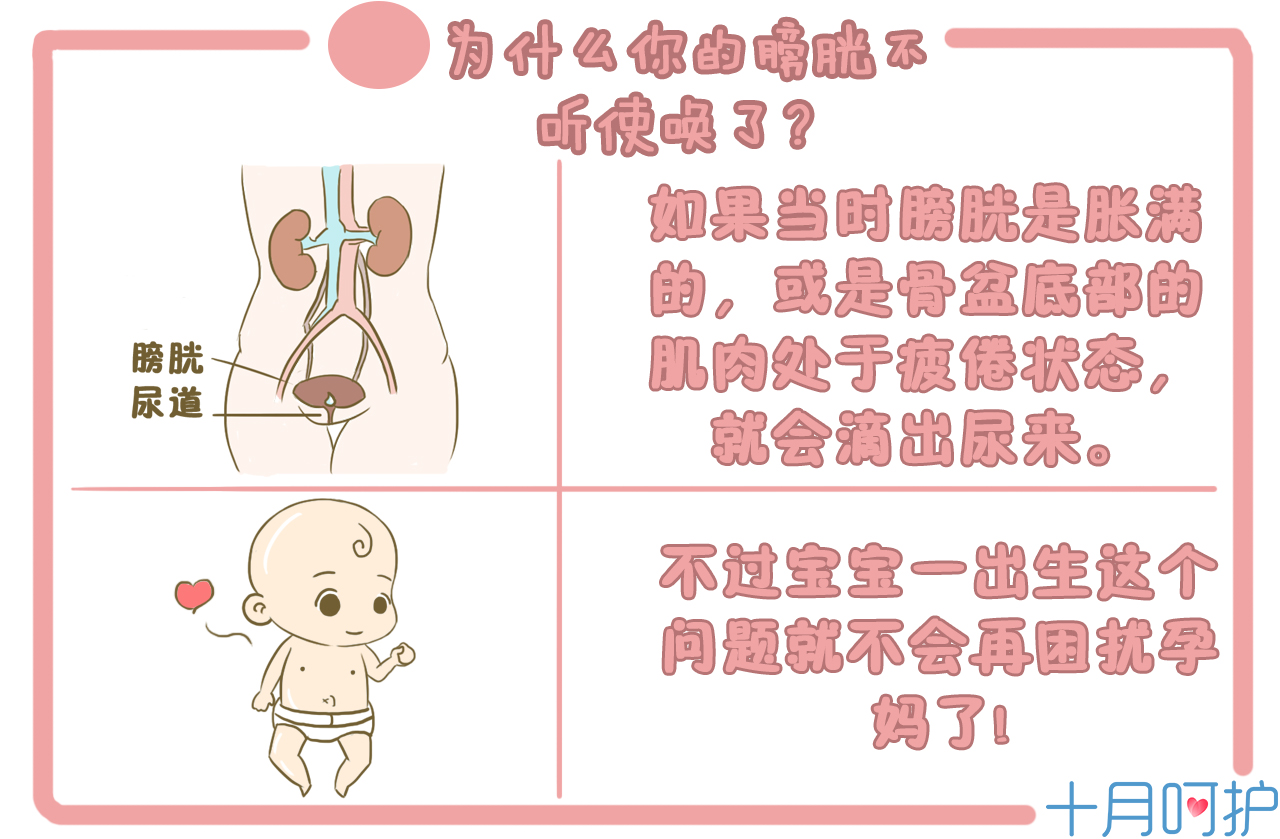 孕期尿裤子怎么处理,孕妇出现尿裤子如何控制与改善