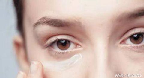 血管型黑眼圈补什么维生素,血管型黑眼圈用什么护肤品去除