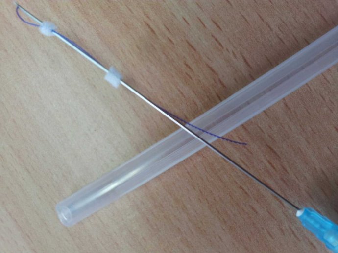 埋蛋白线要多少钱,蛋白埋线提升可以保持多久