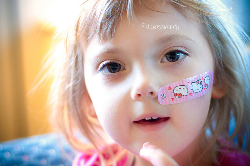 家里有小宝宝的难免磕磕碰碰,家里有小活宝