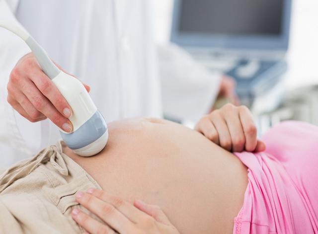 解答孕妈咪们对胎心胎动最关心的20个小问题~