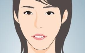 龅牙对面貌的影响,龅牙矫正后对家庭还会有影响吗