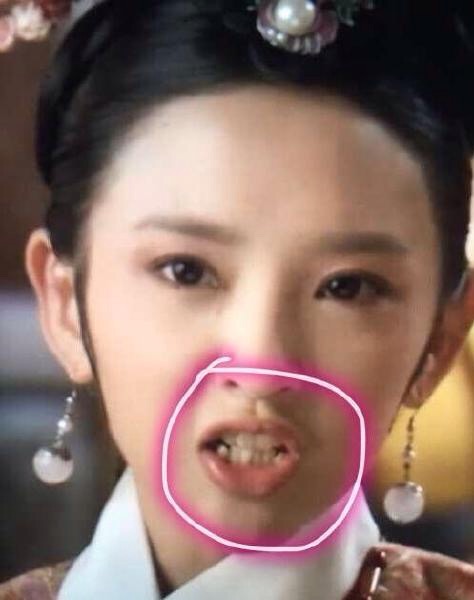 整容整牙齿,整牙微整容