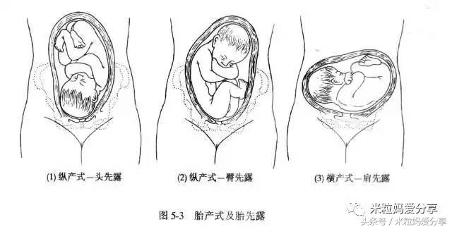 angelababy是顺产还是剖腹产的,angelababy是顺产还是剖腹产