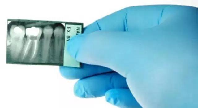 厉害了！她用缝衣针来治疗牙疼