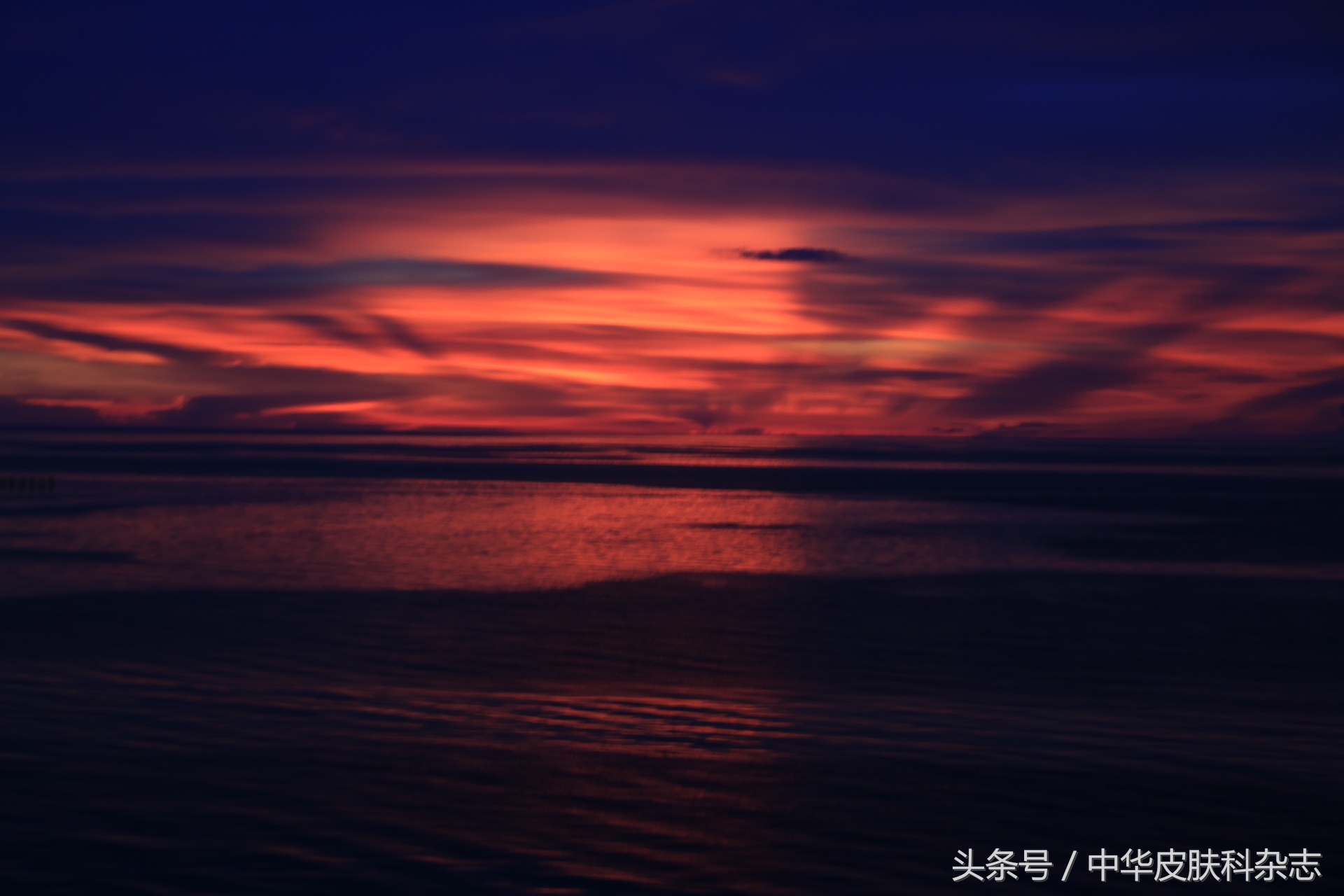 尖锐性湿疣怎么避免复发,尖锐性湿疣如果复发怎么办