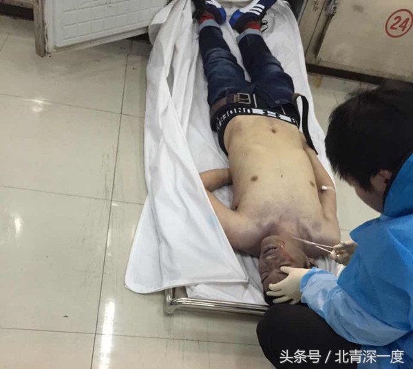 深度聚焦倒在导师饭局后的研究生：5桌师生干掉18瓶酒