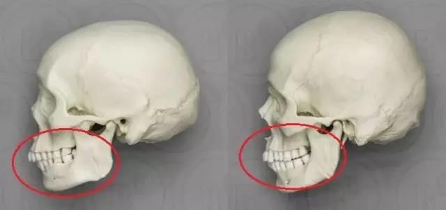 关于法令纹的种种误解,法令纹出现不要怕选对方法很重要