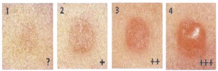 纹眉女子,女子纹眉纹鼻影