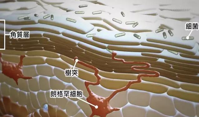 为什么去角质会搓出泥,去角质搓出来的是泥吗