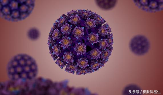 女性尖锐性湿疣的治疗方法,女性尖锐性湿疣治疗办法