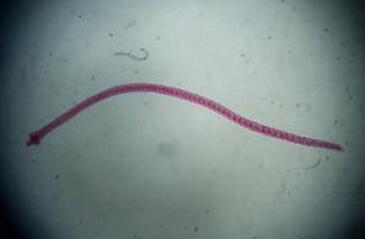 过年不要乱吃东西，有些美食里面住着寄生虫！