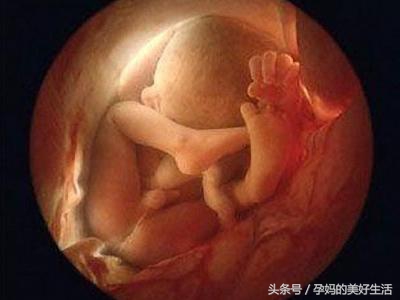 脐带绕颈3周纠正过来的成功案例,脐带绕颈一周可以做胎位纠正操吗