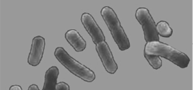 酸奶酵母菌的做法,制作酸奶要真菌还是细菌