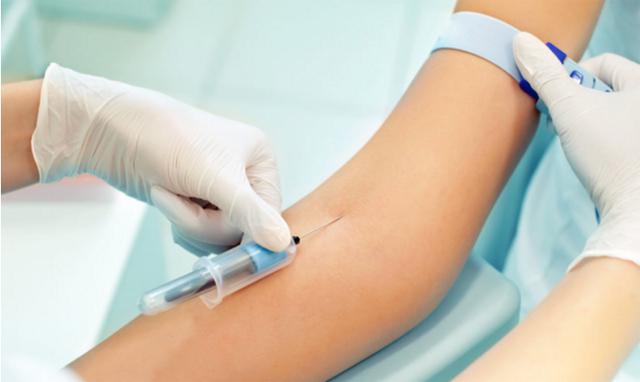 割双眼皮轻微痛感正常吗,割双眼皮很痛吗