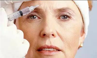 您了解脸上的皱纹吗?