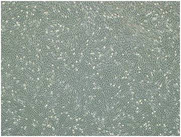 2016脐带血那些事儿---科研进展篇