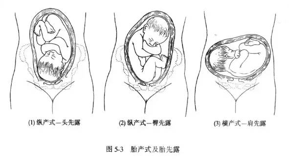 「科普」剖腹产的女明星那么多,为啥瘦小的“教主夫人”(杨颖)却能顺产?